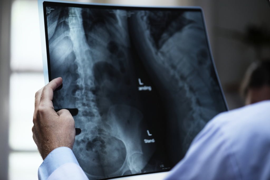 Devices & Resources for Back Pain or Spine Issues